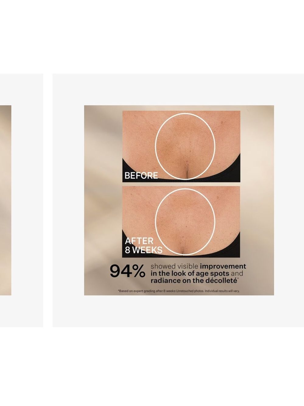 StriVectin TL Advanced ™ Tightening Neck - Picture 8 of 9